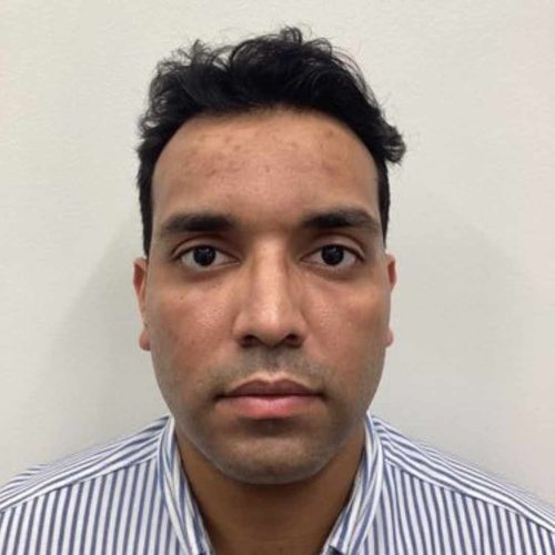 Helix Before and After - Case 14, Image 1 - Male, age 35 – 44 - Lafayette, IN - Pure Regenerative Medicine