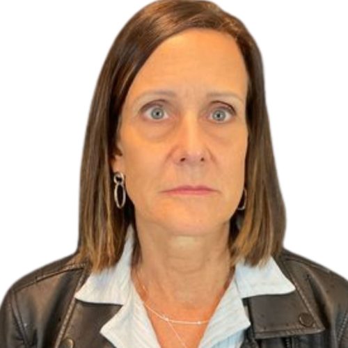 Helix Before and After - Case 12, Image 2 - Female, age 45 – 54 - Lafayette, IN - Pure Regenerative Medicine